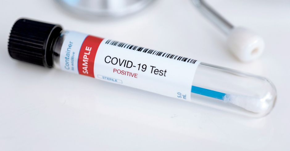 Pruebas de Covid-19 a gran escala por saliva, una medida por aplicar ante el incremento de casos, consideran investigadores