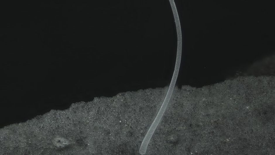 La impresionante imagen de la bacteria más grande del mundo recién descubierta