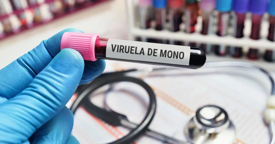 Costa Rica alcanza 70 casos de viruela del mono durante 2022